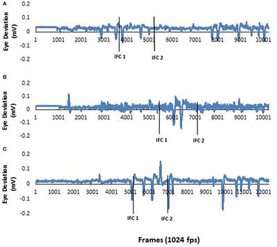 Visual Cues Promote Head First Strategies During Walking Turns in Individuals With Parkinson's Disease